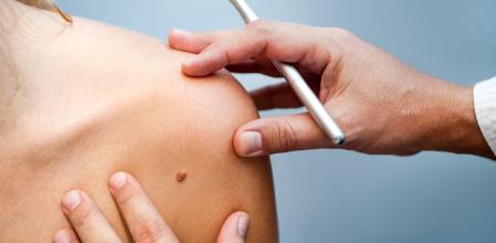 Corrientes se suma a la campaña nacional contra el Cáncer de Piel