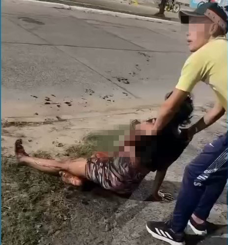 Choque de motos: el dramático relato de la mamá de la chica amputada