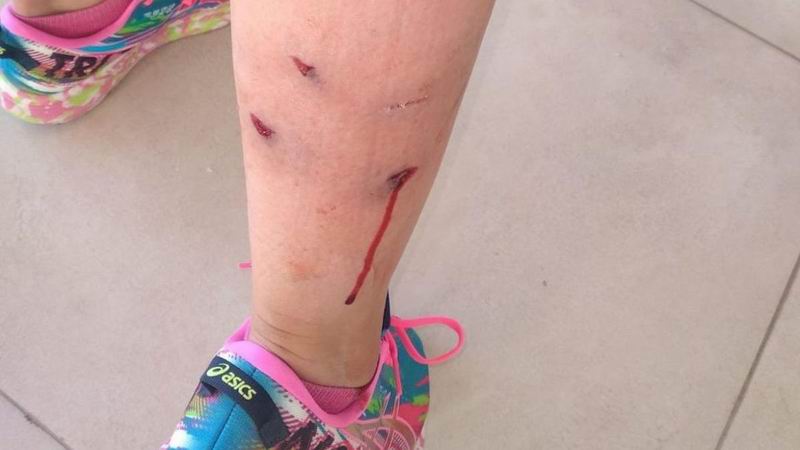 Preocupación sanitaria nacional por el aumento de mordeduras de perro