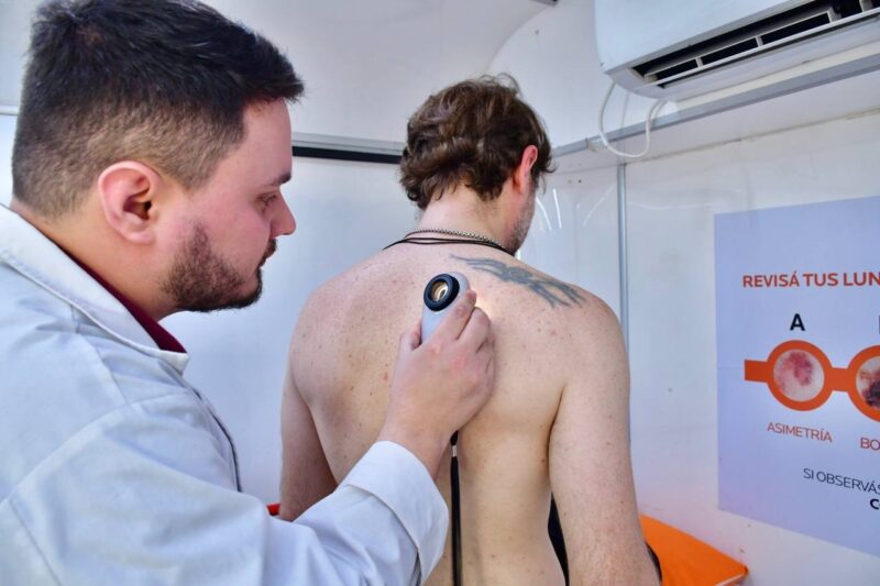 Se realizarán testeos dermatológicos gratuitos en la Costanera