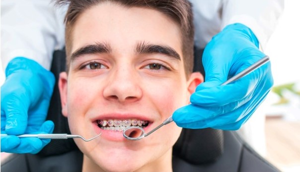 ¿Cuánto cuesta una sonrisa perfecta?: los factores que definen el precio de los brackets