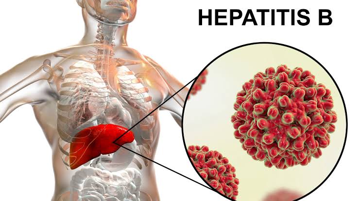 Hepatitis: ¿Por qué la vacunación es la clave para evitar esta enfermedad?
